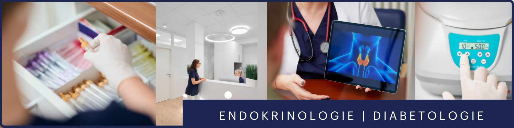 Endokonsil